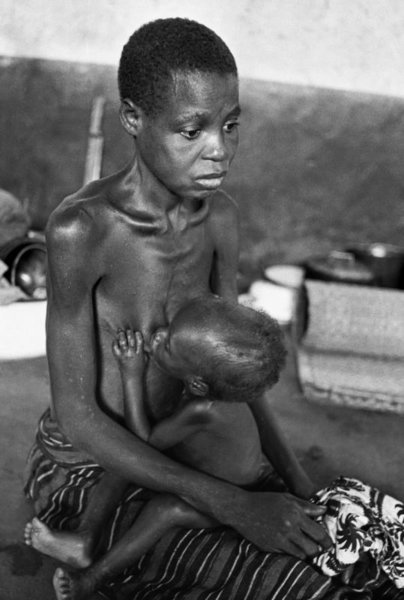 Biafran War